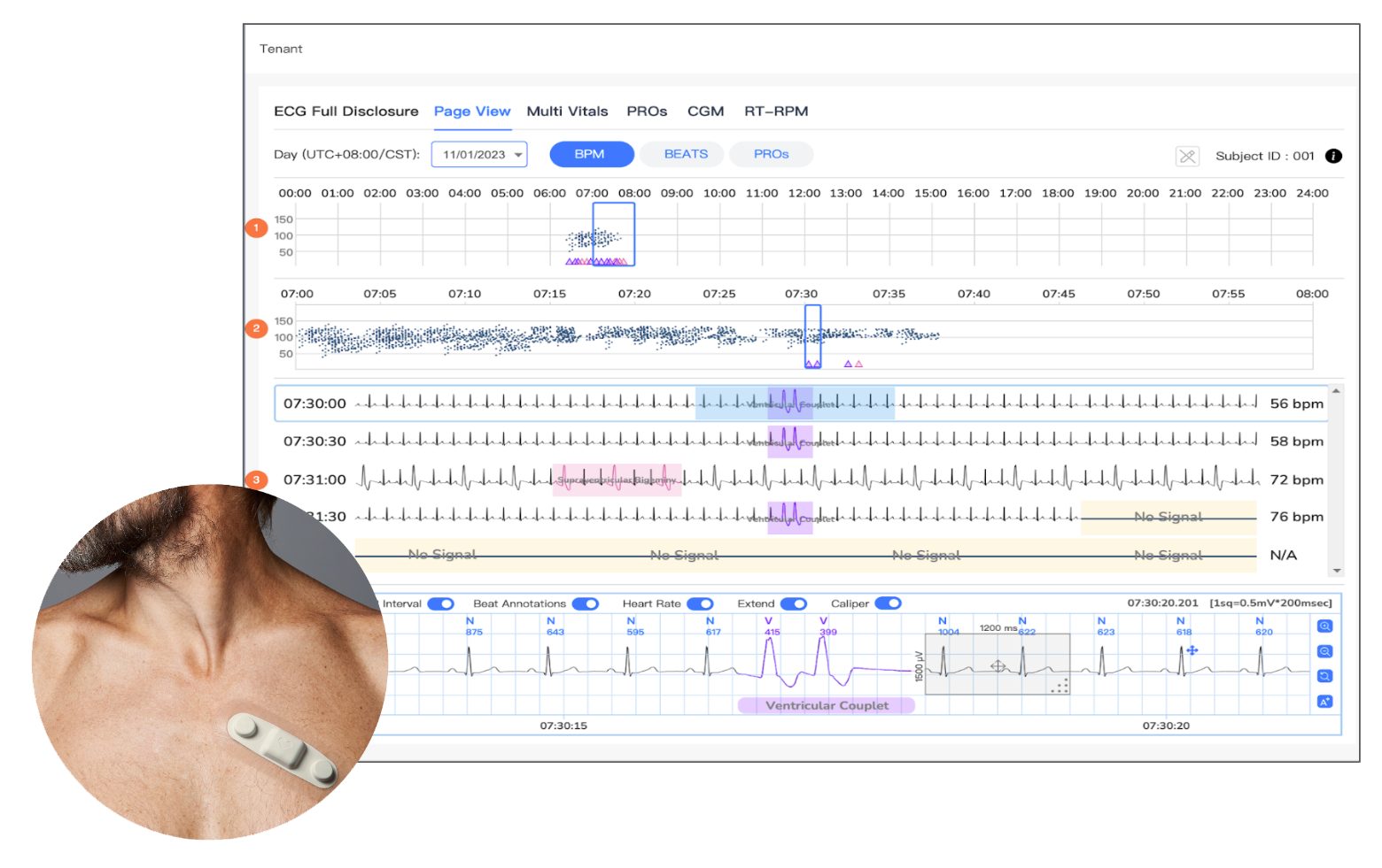 Cardiac Monitoring Transparent