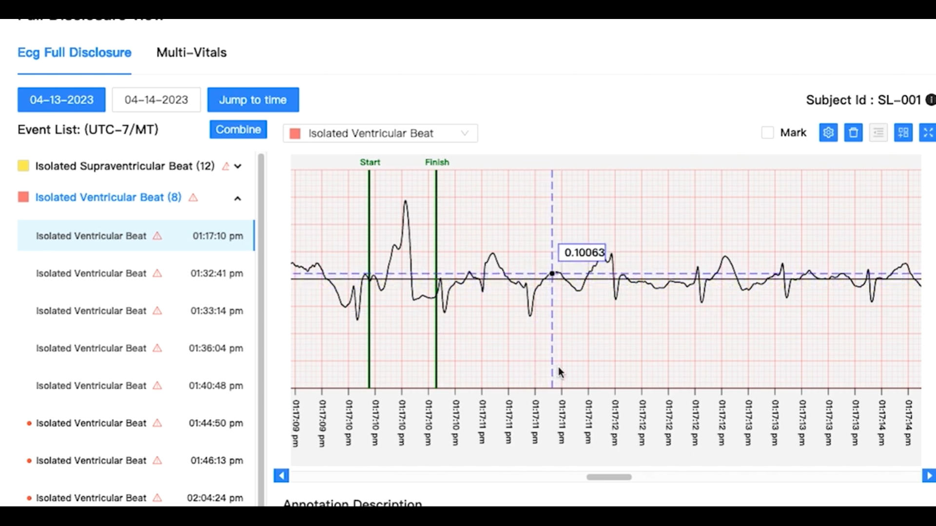 ECG Caliper