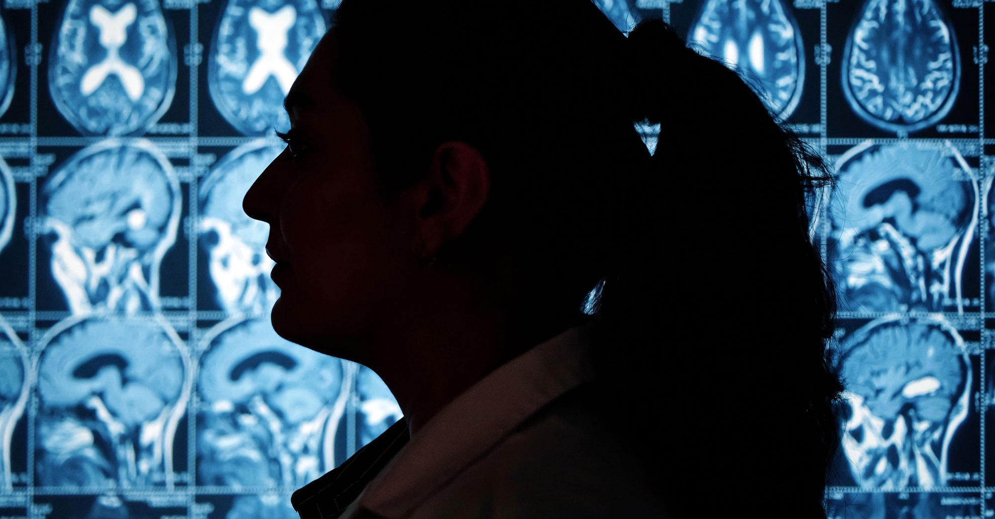 oschner-khan-seizure-study-featured-optimized