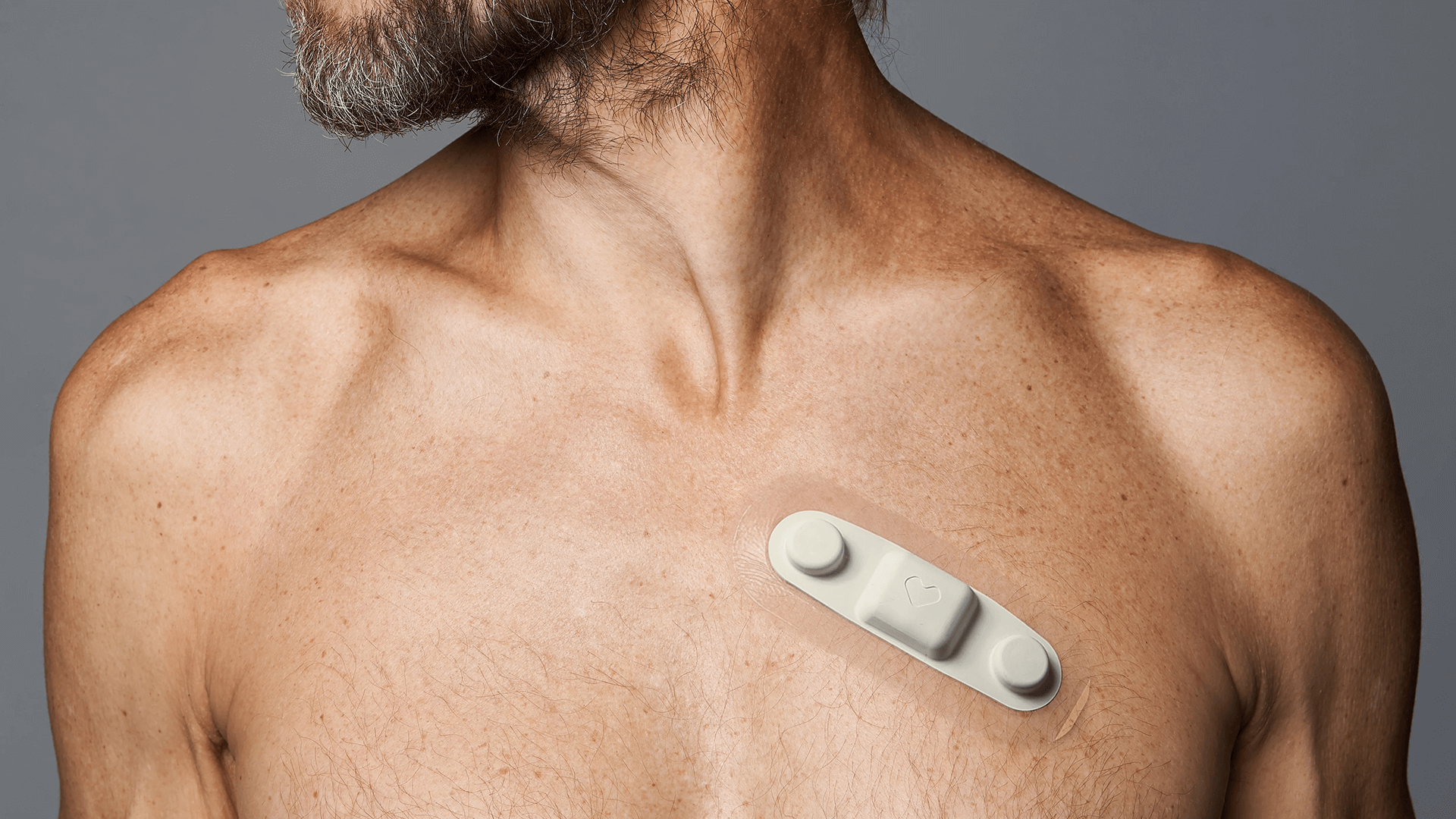 How continuous cardiac monitoring is supporting safer chemotherapy treatment.