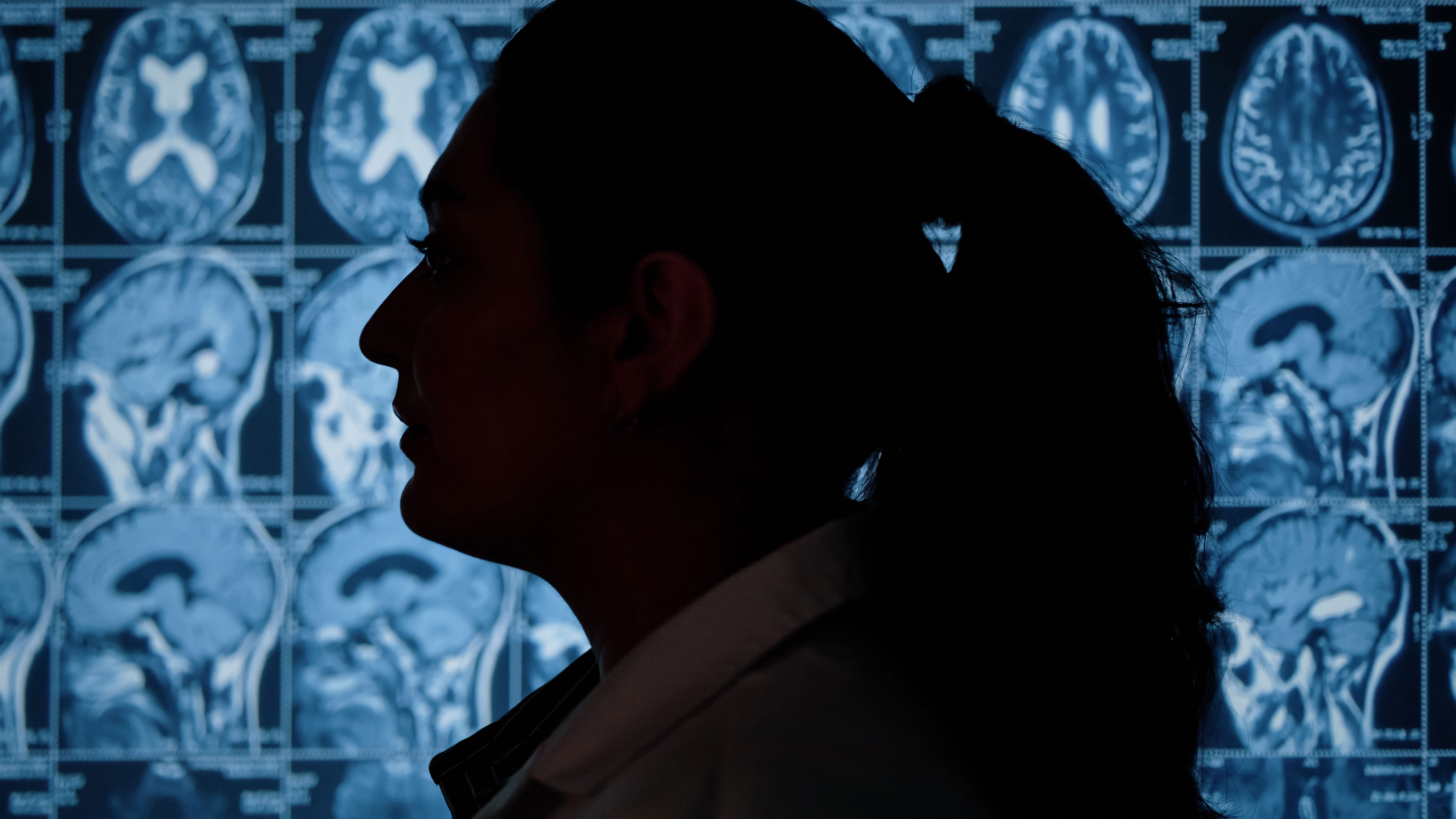 oschner-khan-seizure-study